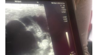 mare-ultrasound